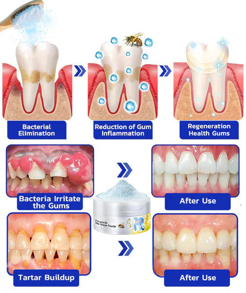 Smileasego™ Focussmile bee venom treatment powder for oral use🦷